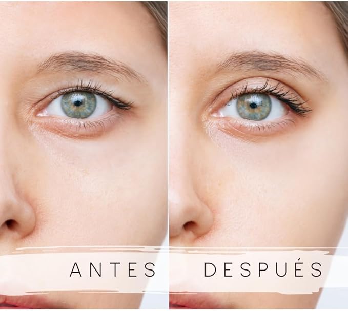 Levantaparpados Eyelid x 120 unidades